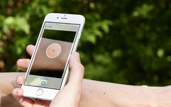 SkinVision Unveils Breakthrough Algorithm that Takes the Fight to Skin Cancer